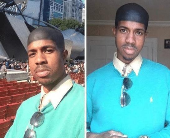 秃顶治疗最新技术,探索自然美景的旅程