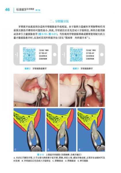 最新拔牙技术,轻松解决牙齿烦恼