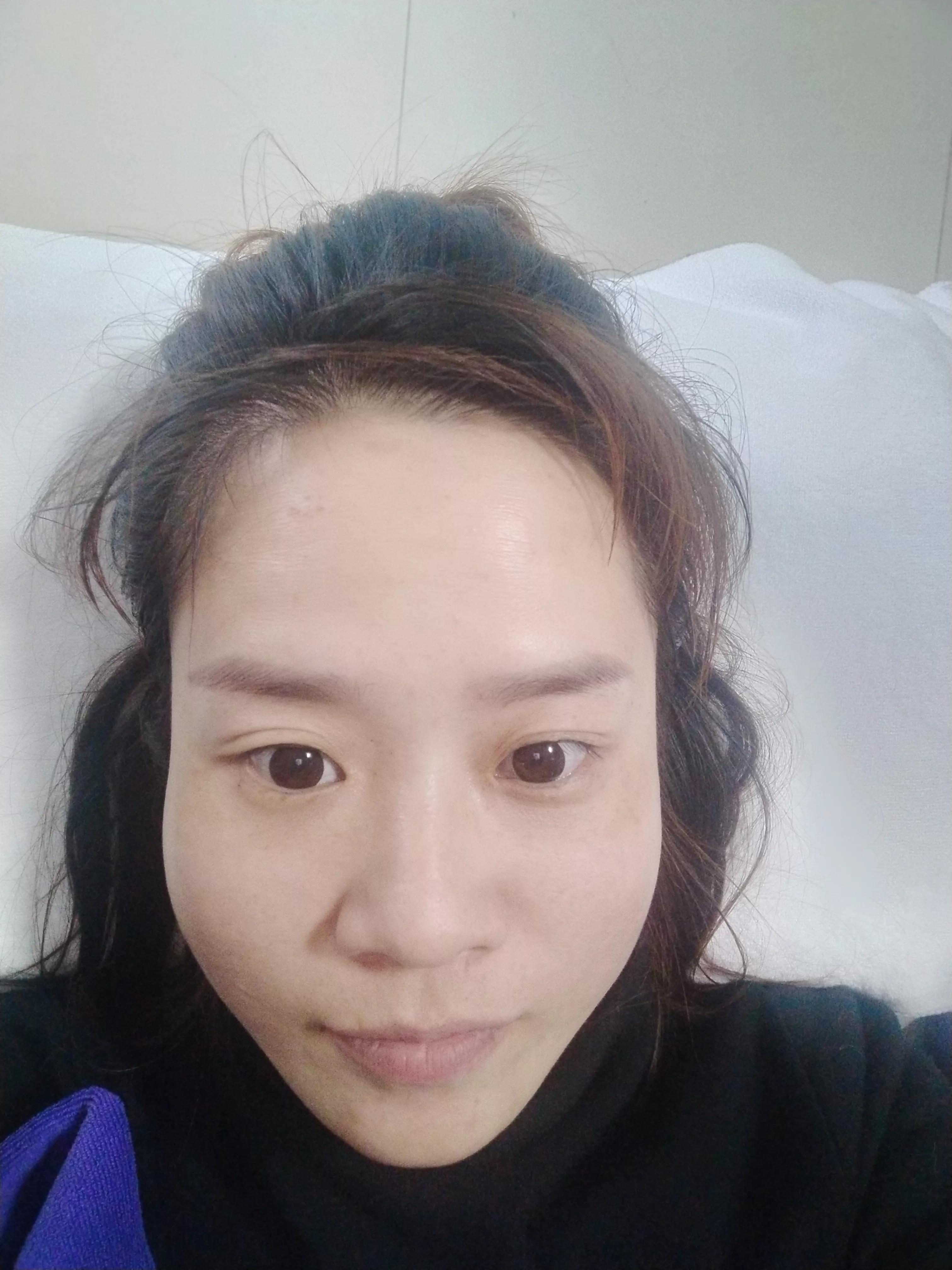 热玛吉最新进展，引领你进入全新的抗衰之旅💖